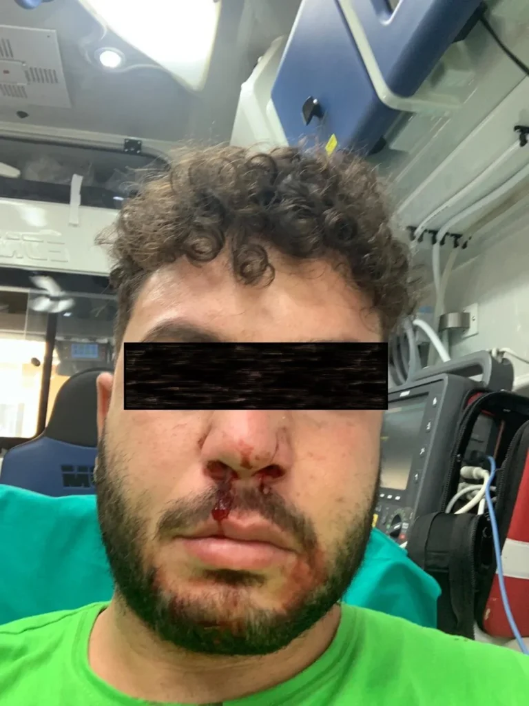 netturbino aggredito palagiano